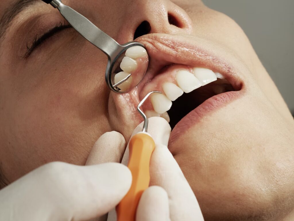 Can poor dental health kill you? the answer will surprise you